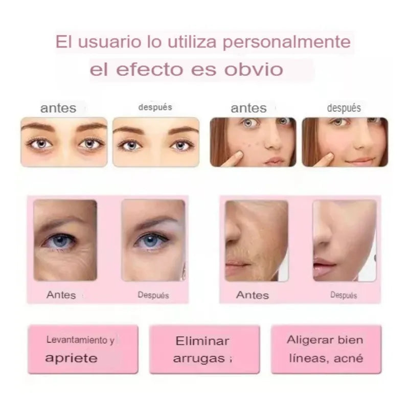 Masajeador Ultrasónico Limpieza Facial